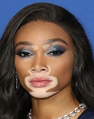 Winnie Harlow